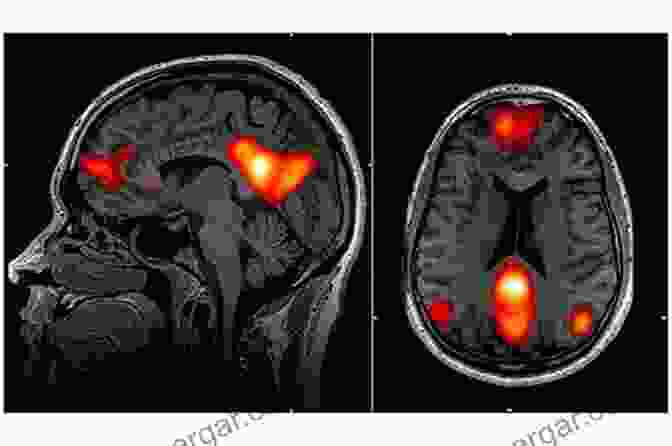 Brain Scan Showing Increased Activity In The Prefrontal Cortex During Telekinetic Attempts Telekinesis Secrets Finally Revealed