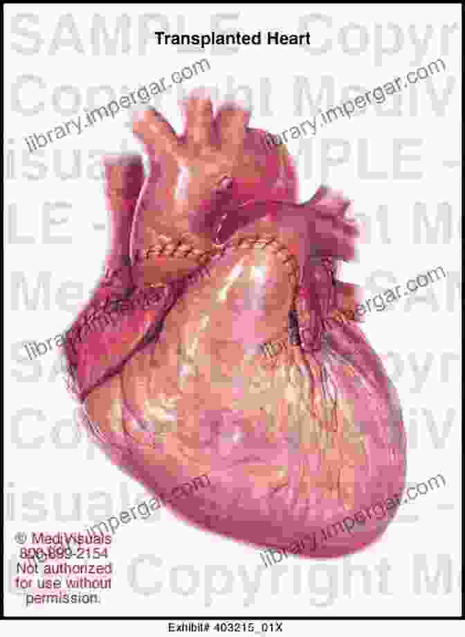 Illustration Of A Heart Being Transplanted From One Person To Another Organ And Tissue Donation And Recovery: The New Jersey Requirement