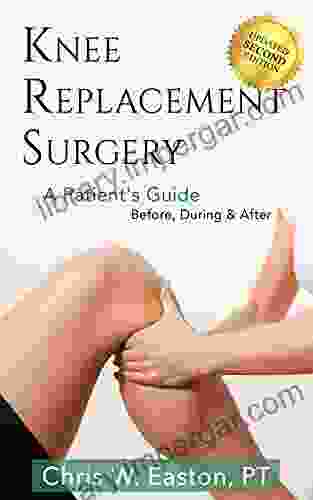 Knee Replacement Surgery A Patient S Guide: Before During After