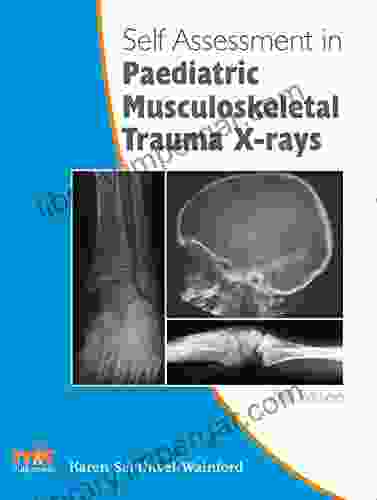 Self assessment in Paediatric Musculoskeletal Trauma X rays (Self Assessment in X rays 4)