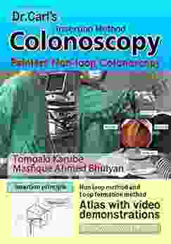 Dr Carl S Colonoscopy Insertion Method